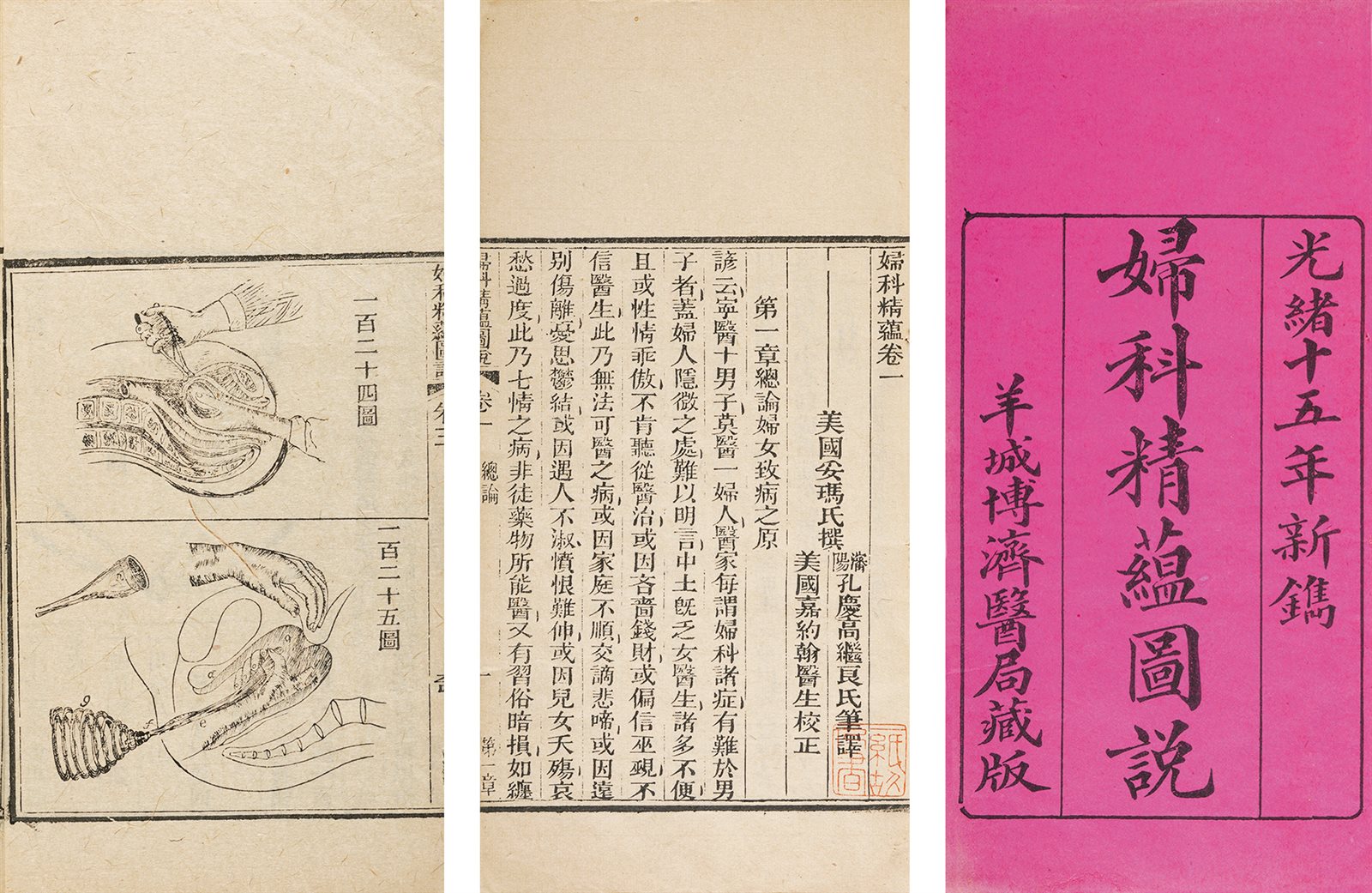 妇科精蕴图说·五卷 清光绪十五年（1902）羊城博济医局刊刻