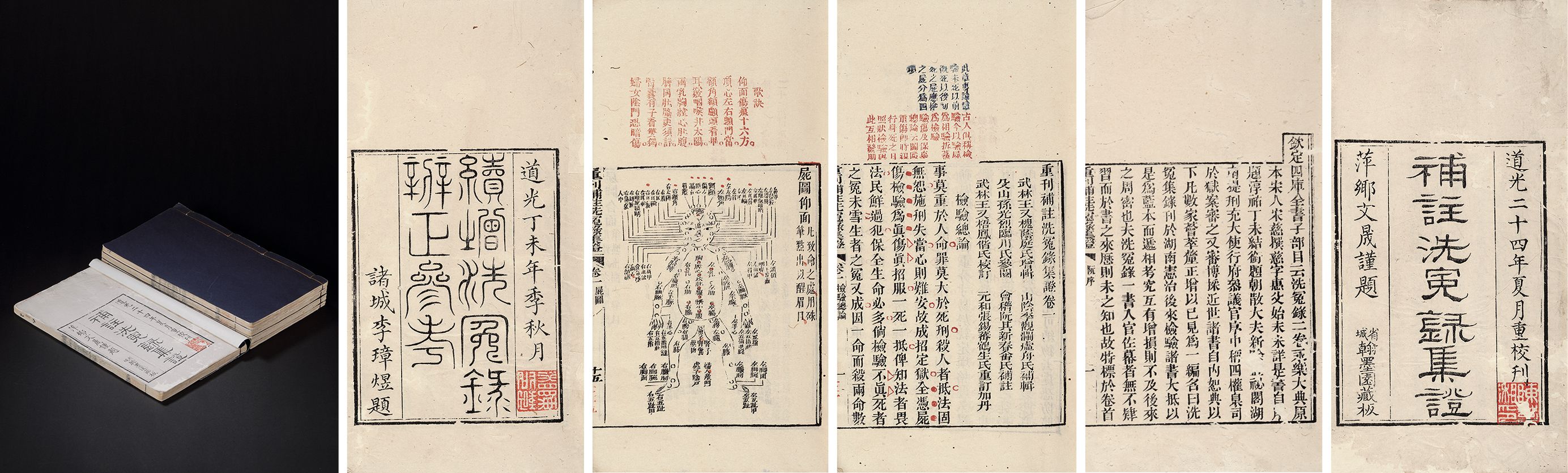 重刊补注洗冤录集证·六卷 清道光二十四年（1844）四色套印本（翰墨园藏板）